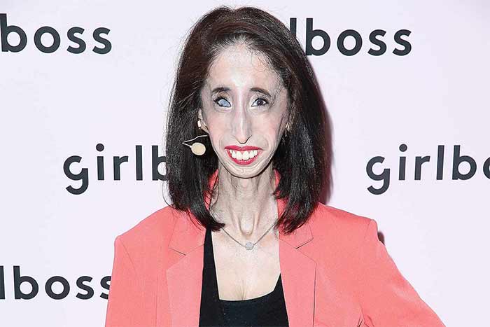 لیزی ولاسکز