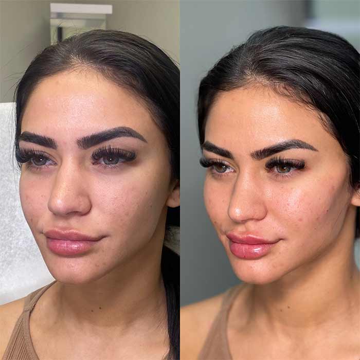 گونه‌گذاری