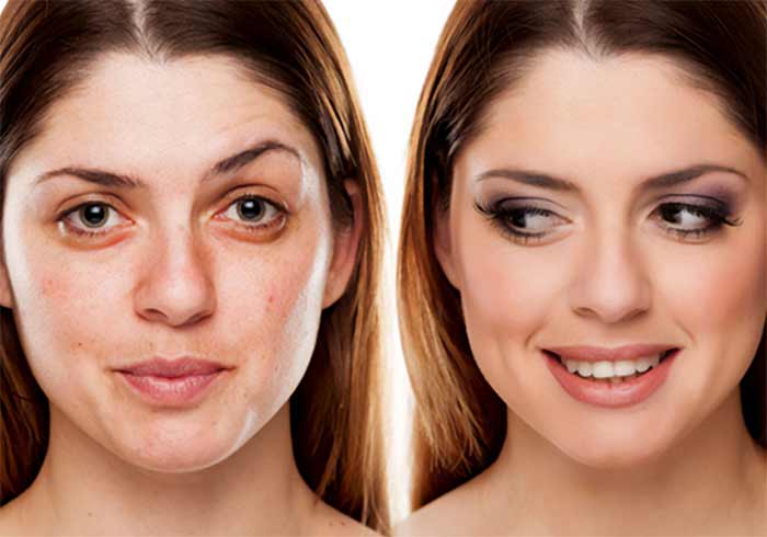 جراحی زاویه‌سازی فک