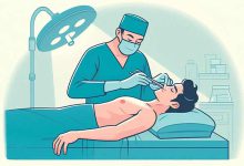 جراحی عمل بینی