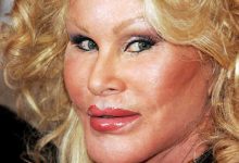 افتضاح ترین عمل های زیبایی دنیا و آمار و حقایق جالب