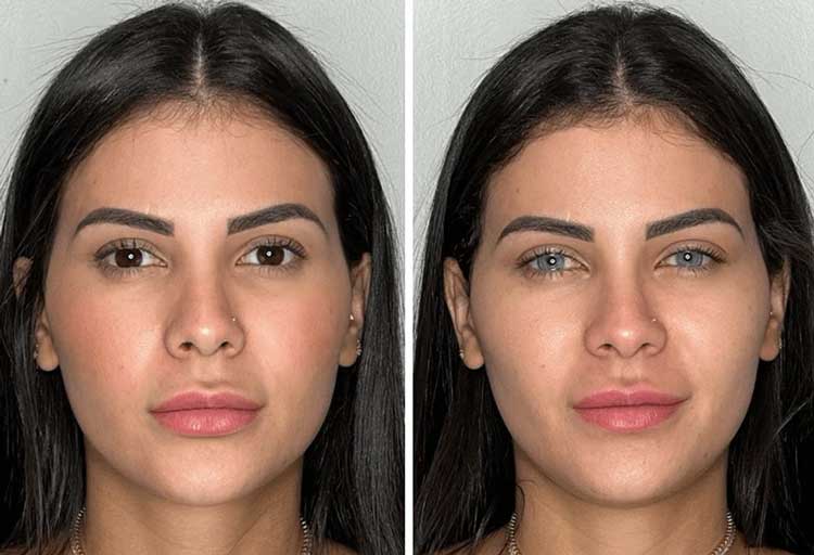 تغییر رنگ چشم