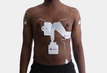 لید در پزشکی و لید قلبی چیست؟ بهمراه عکس لید نوار قلب