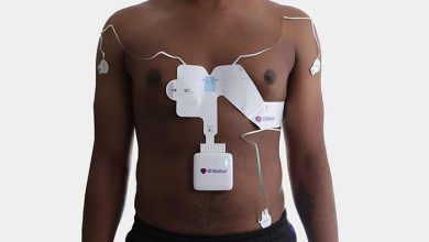 پزشکی لید در پزشکی و لید قلبی چیست؟ بهمراه عکس لید نوار قلب