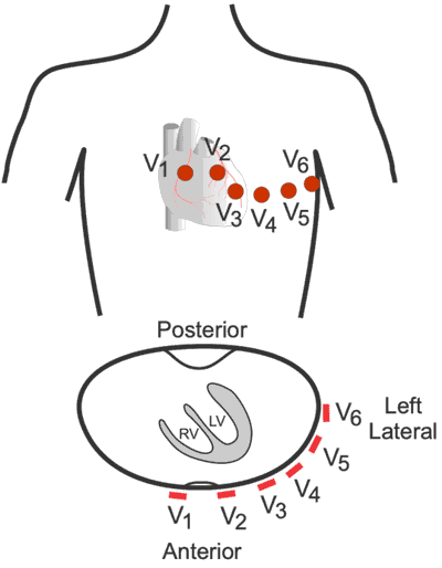 لیدهای نوار قلب