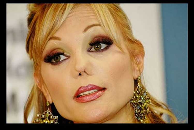 رینوپلاستی ناموفق