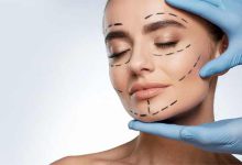 7 بزرگترین عمل جراحی تغییر چهره در ایران+ عکس