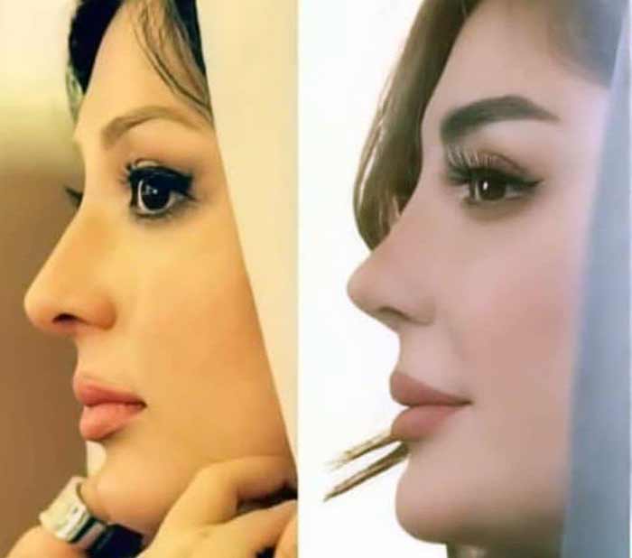 نیوشا ضیغمی